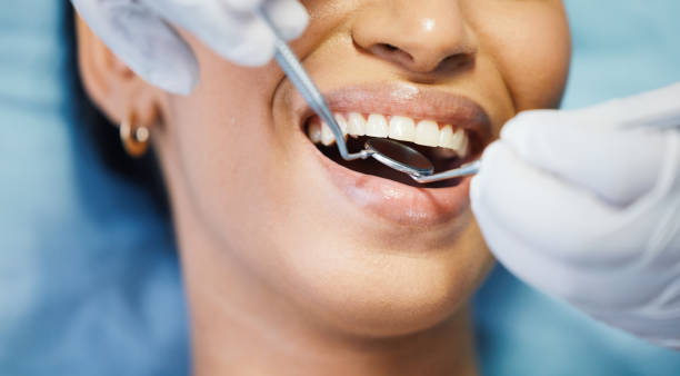 Best Emergency Denture Repair in Hampton, IA
