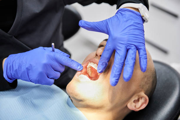 Best Emergency Tooth Extraction in Hampton, IA