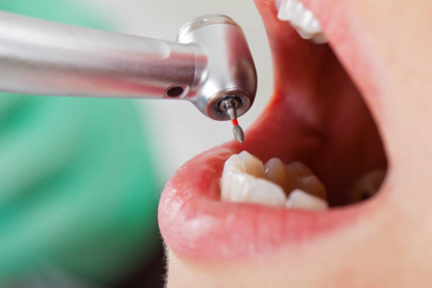 Best Cosmetic Emergency Dentistry in Hampton, IA